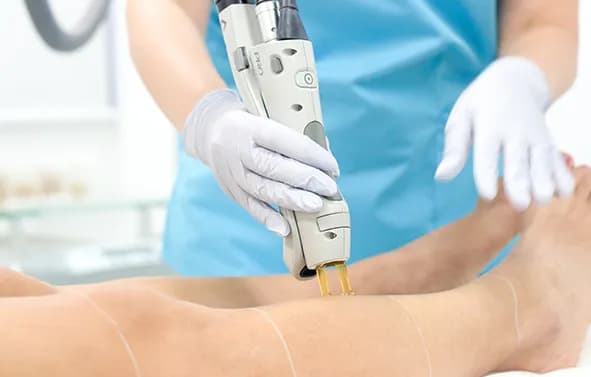 About Vascular Laser Treatment