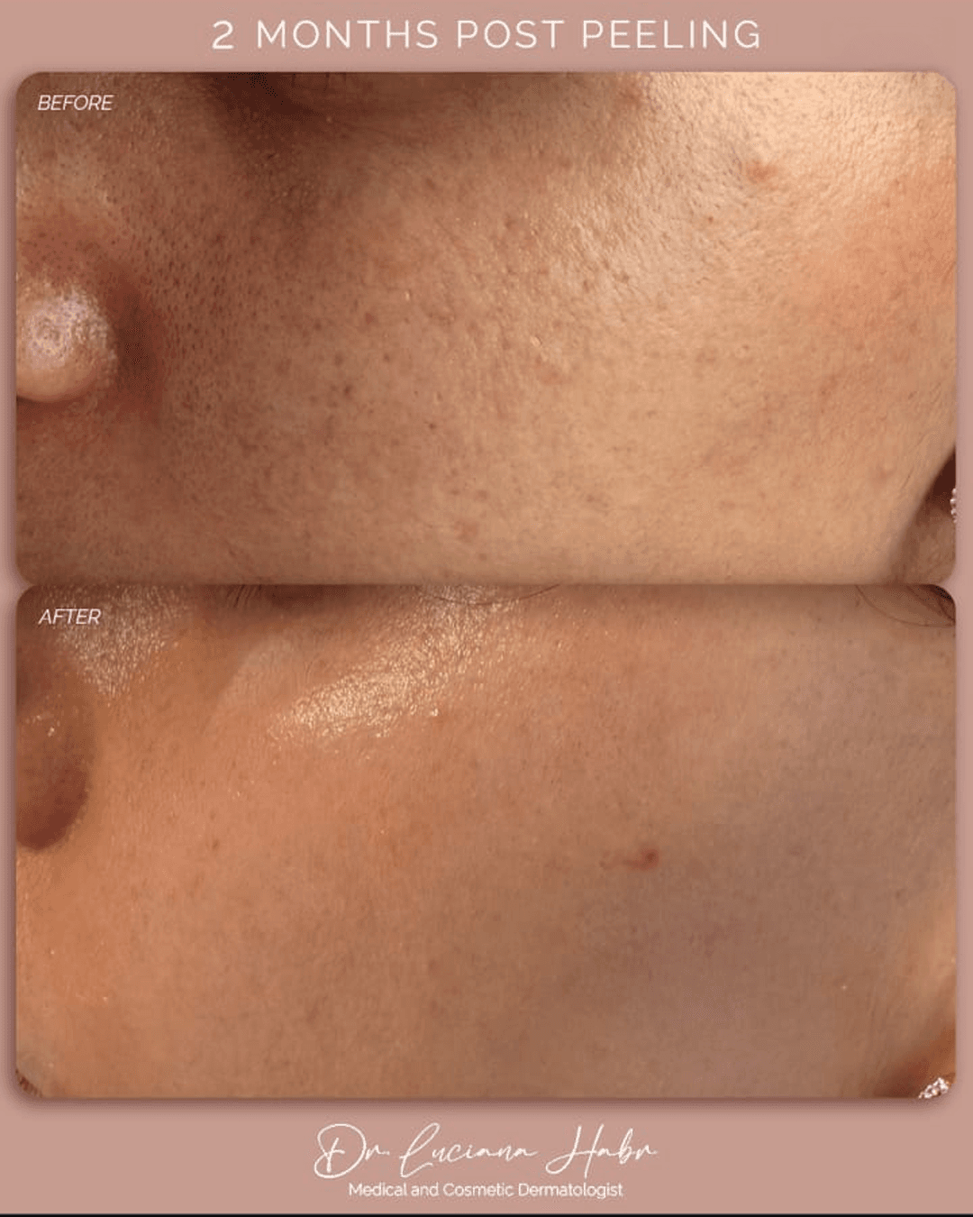 Real Patients, Real Results. – patient result 2