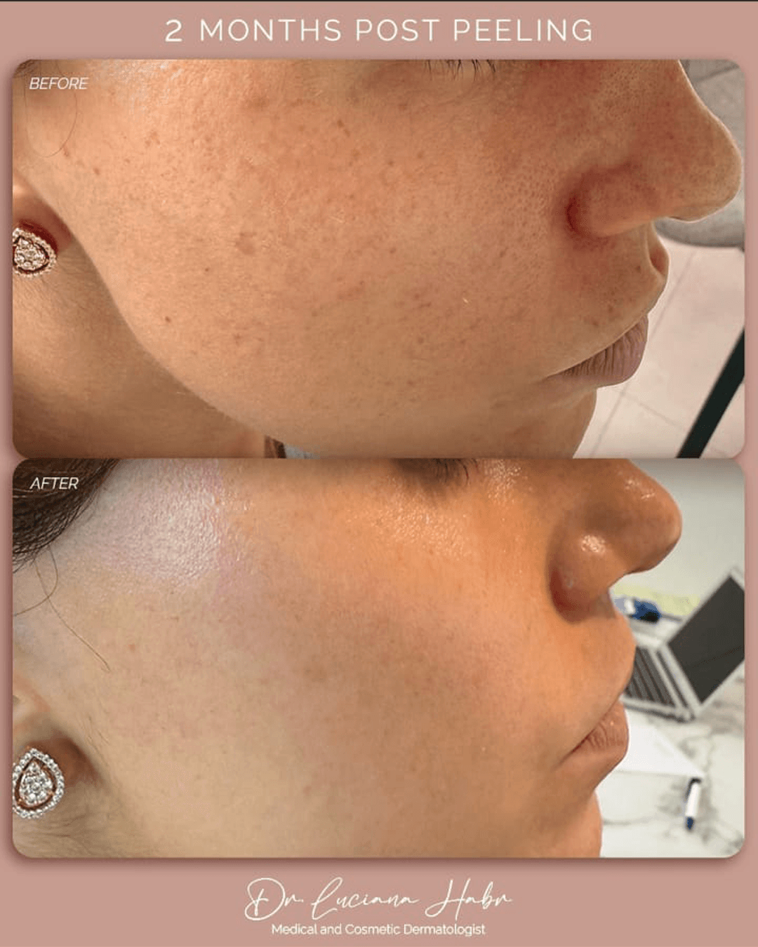 Real Patients, Real Results. – patient result 3