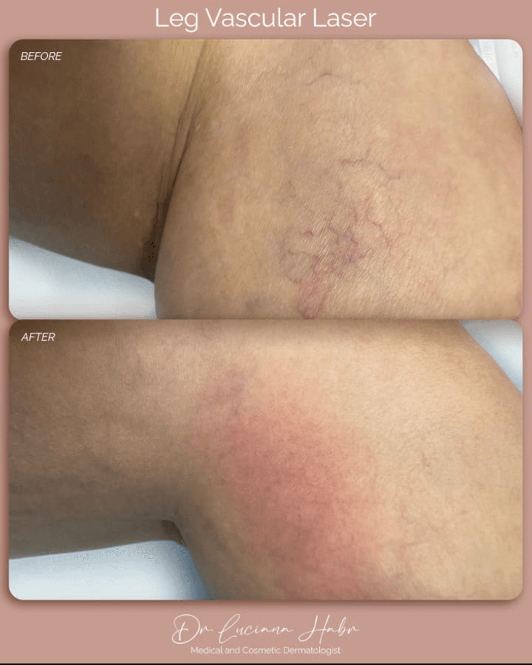 Real Patients, Real Results. – patient result 1