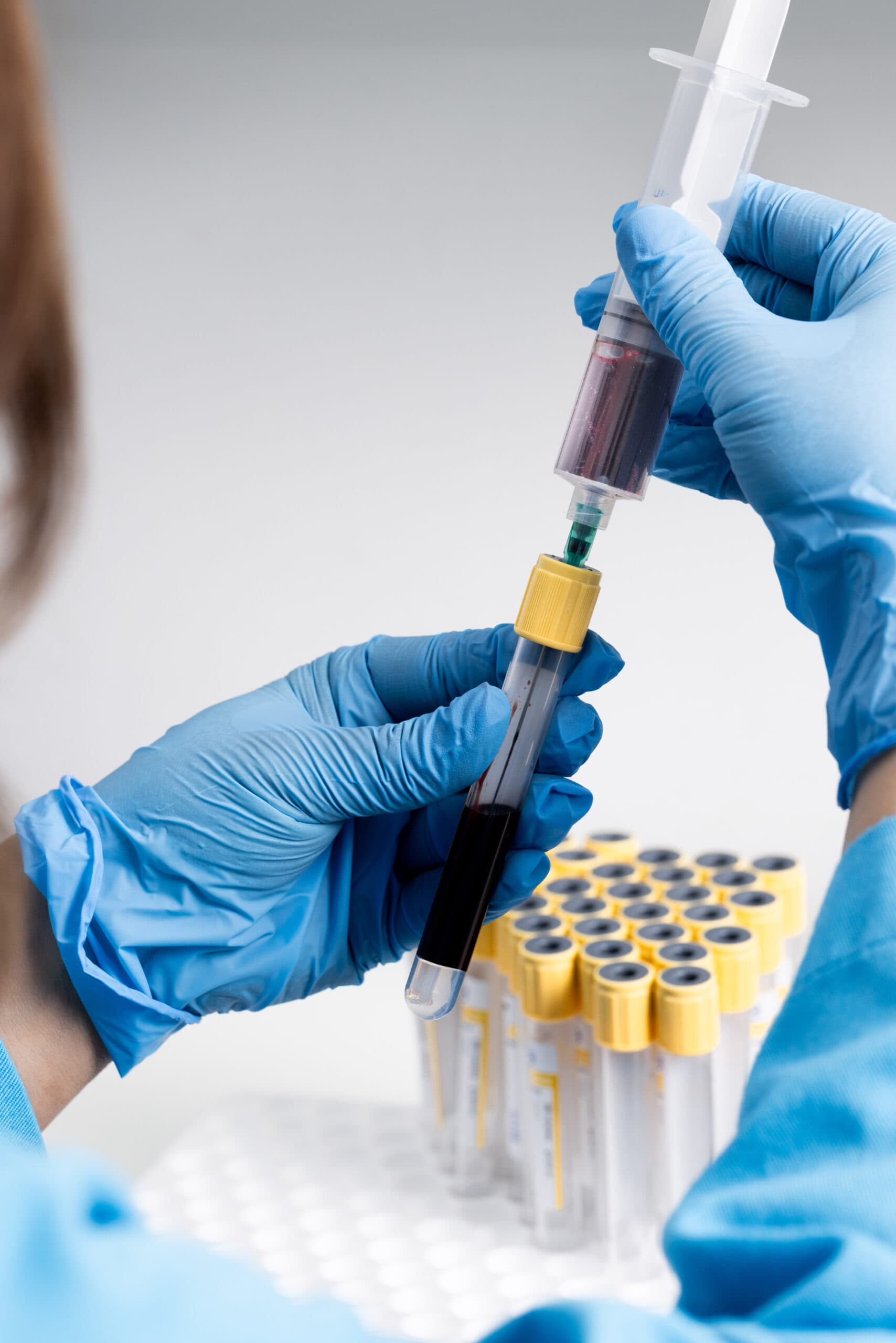 A blood sample being prepared for processing