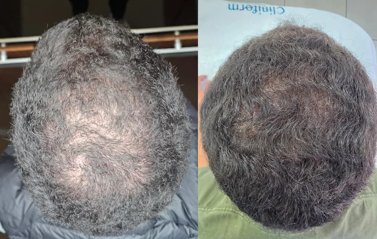 Real Patients, Real Results. – patient result 1
