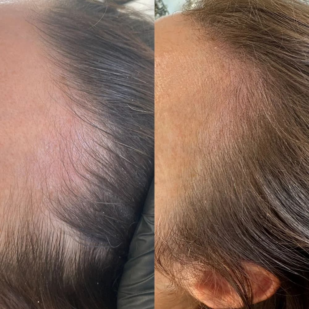 Real Patients, Real Results. – patient result 2