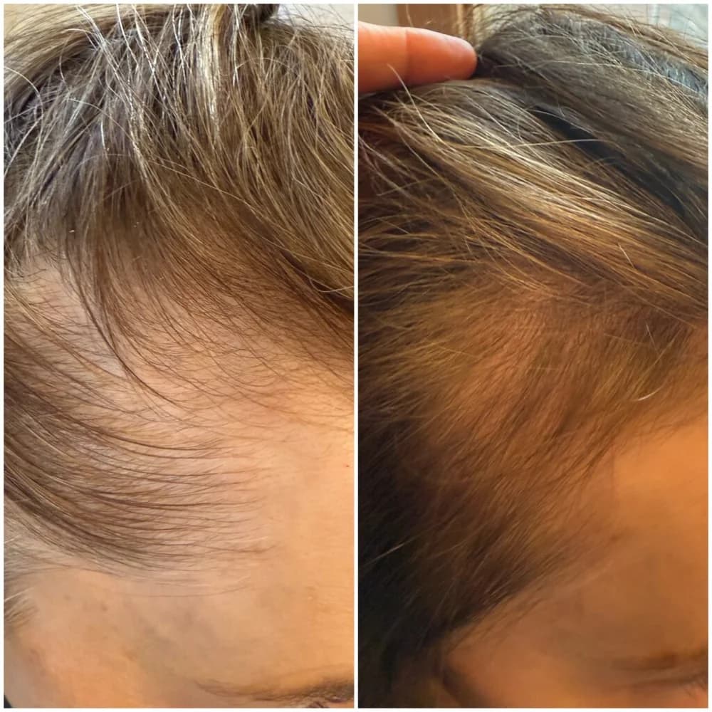 Real Patients, Real Results. – patient result 3