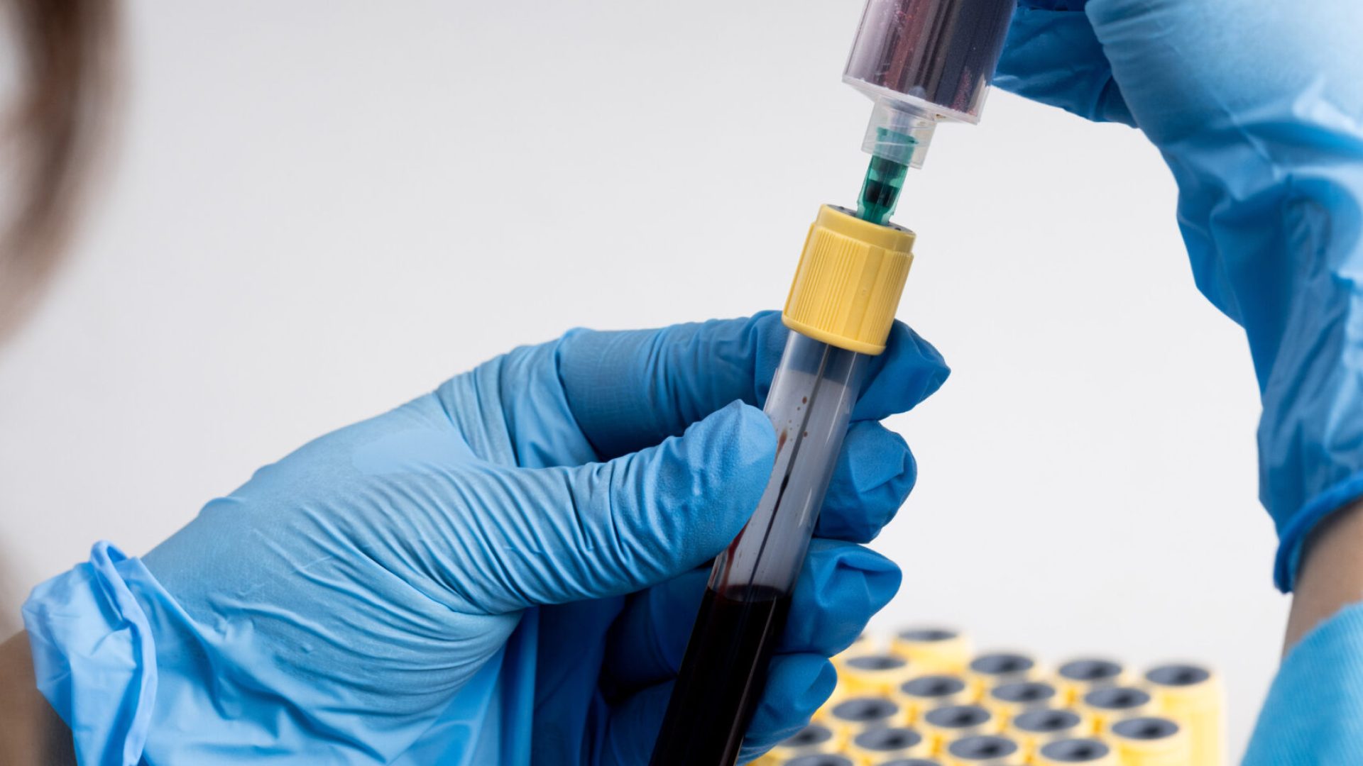 How it works PRP Hair